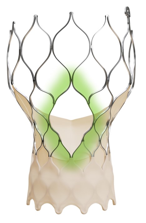 Medtronic Introduces Evolut™ FX+ in India — A Move Forward in TAVI Therapy for Aortic Stenosis